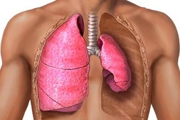 neumotórax colapso pulmonar